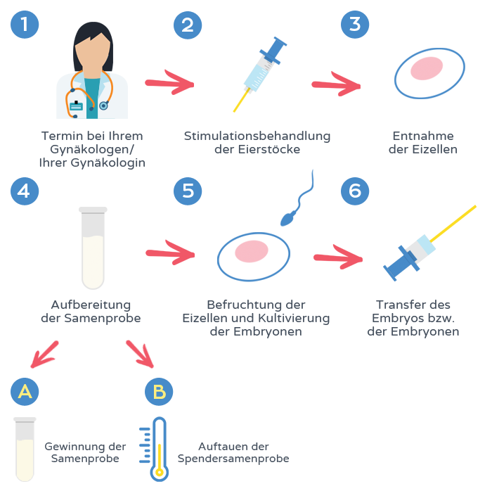 In-vitro-Befruchtung - Verfahren