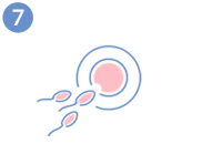 Eizellenspende - Befruchtung der Eizelle und Kultivierung der Embryonen