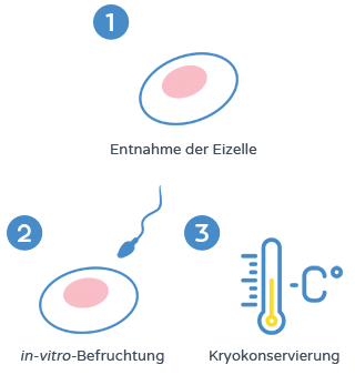 Erhalt der Fruchtbarkeit - Kryokonservierung von Embryonen